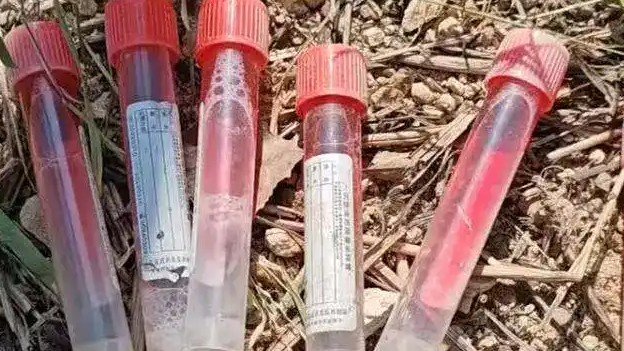 枣庄儿童福利院外现多支病毒采样管