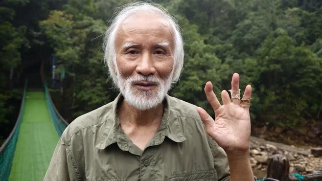 捐赠者为研究莽山烙铁头手指中毒截肢