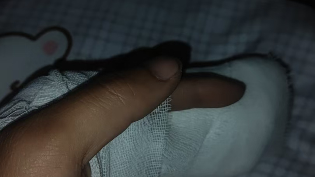 运维员反映电柜倾倒压折手指申请工伤受阻，公司：由专人答复记者