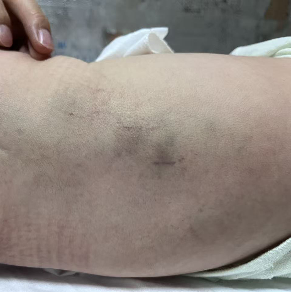 咸阳一新生儿遭月子中心护工拍打案一审裁定：涉嫌虐待，移送公安
