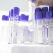 广州一生物公司将“仅供研究”使用的试剂盒用于2306份血液样本临床检测项目