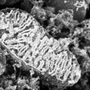 科学家绘制高精度线粒体蛋白质图谱