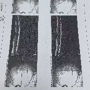 天津一教师被指用激光笔照伤学生眼睛，法院一审判学校赔偿2300余元
