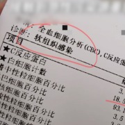 女生称在闲鱼租的婚纱未消毒致皮肤感染，商家：对方投诉不成立