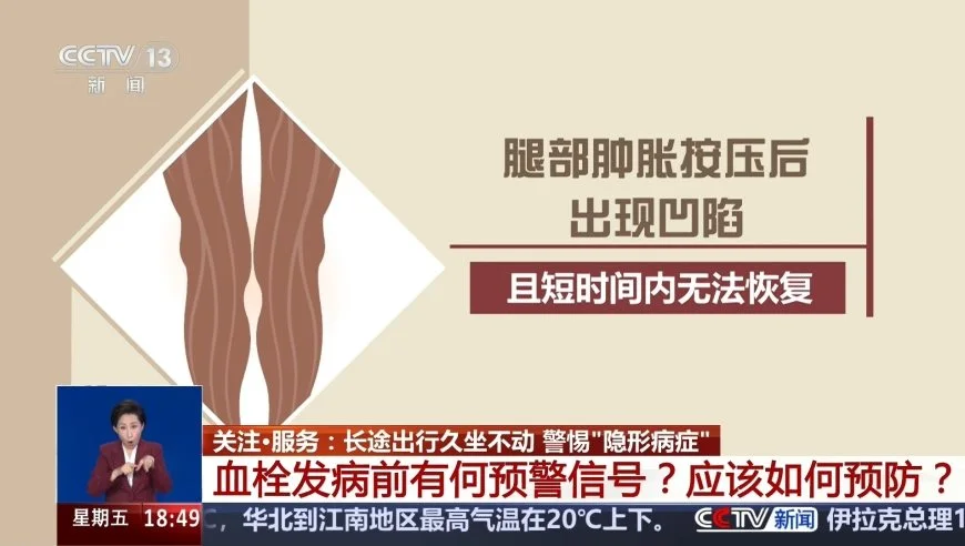 长途出行久坐不动 警惕“隐形病症”