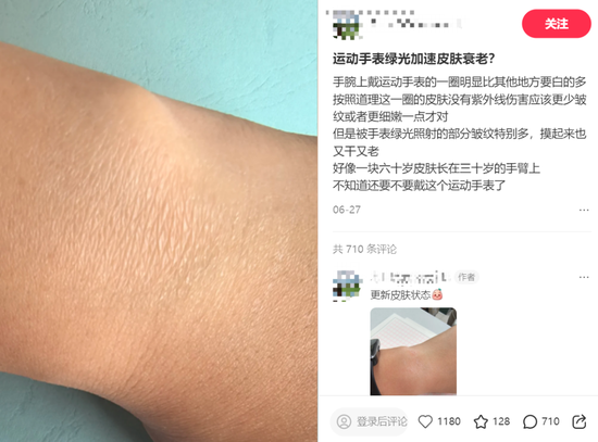 第一批戴运动手环的“受害者”出现了